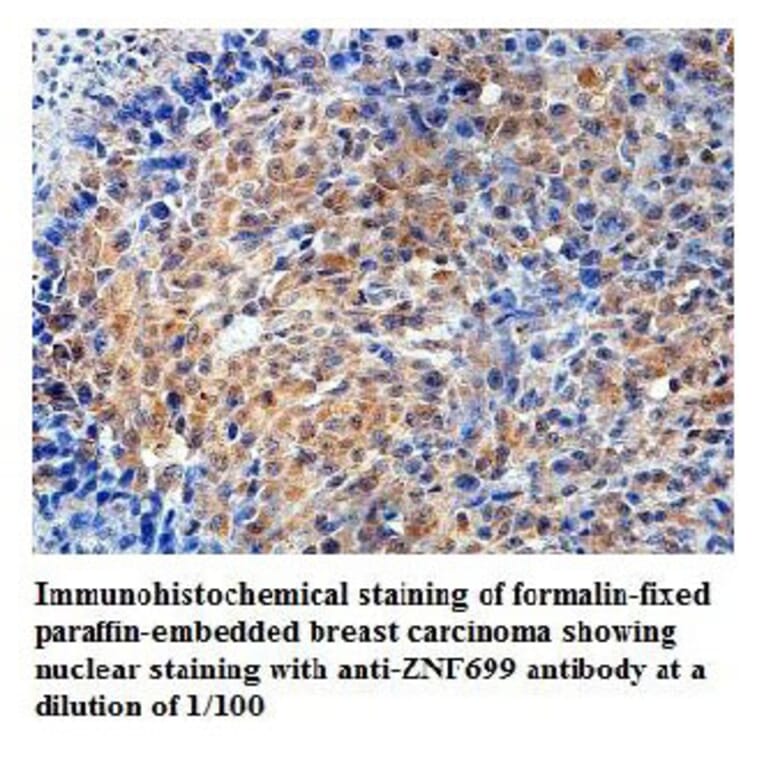 ZNF699 Antibody from Signalway Antibody (39818) - Antibodies.com
