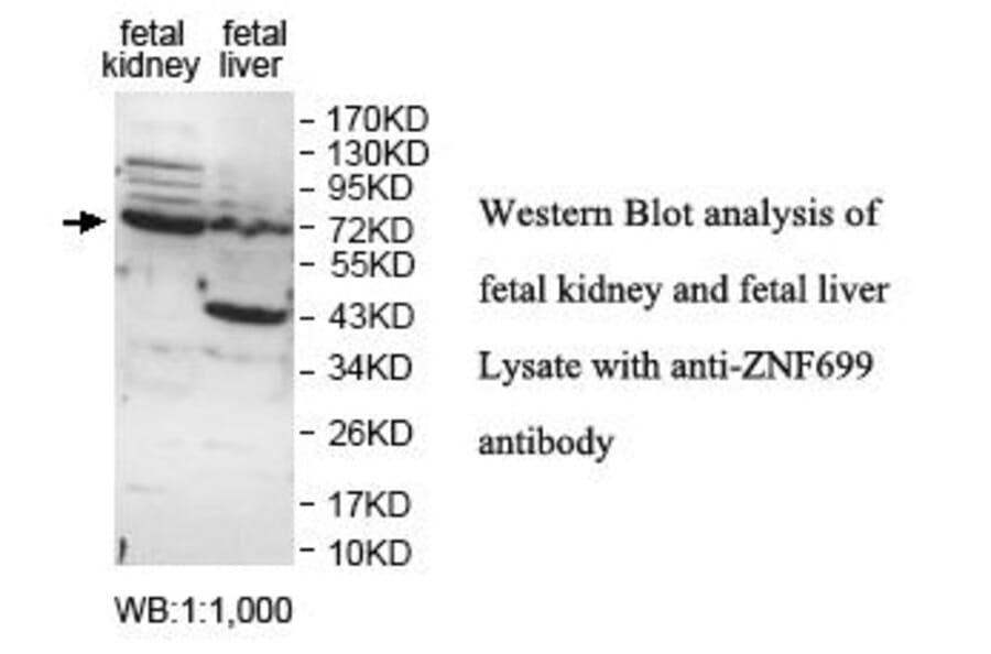ZNF699 Antibody from Signalway Antibody (39818) - Antibodies.com