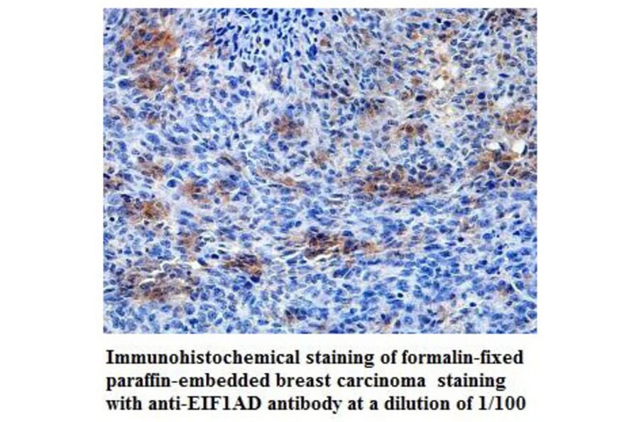 EIF1AD Antibody from Signalway Antibody (39819) - Antibodies.com
