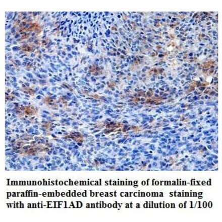 EIF1AD Antibody from Signalway Antibody (39819) - Antibodies.com