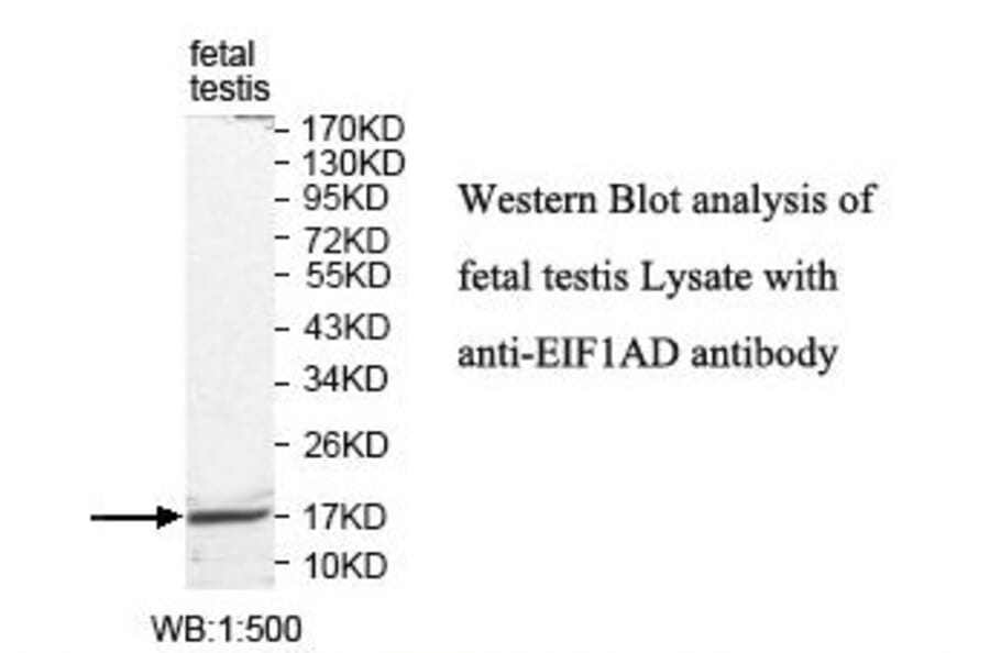 EIF1AD Antibody from Signalway Antibody (39819) - Antibodies.com