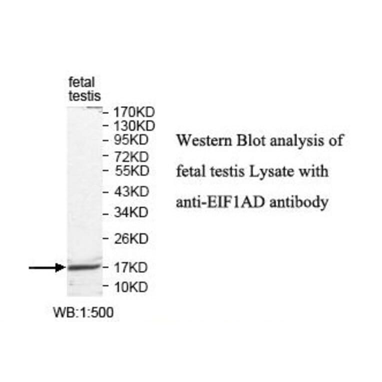EIF1AD Antibody from Signalway Antibody (39819) - Antibodies.com