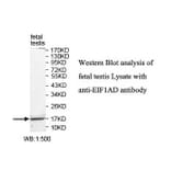 EIF1AD Antibody from Signalway Antibody (39819) - Antibodies.com