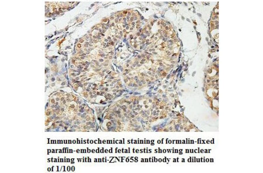ZNF658 Antibody from Signalway Antibody (39820) - Antibodies.com