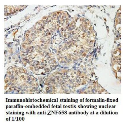 ZNF658 Antibody from Signalway Antibody (39820) - Antibodies.com