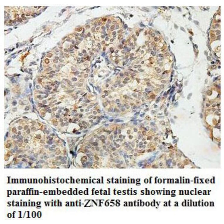 ZNF658 Antibody from Signalway Antibody (39820) - Antibodies.com