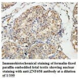 ZNF658 Antibody from Signalway Antibody (39820) - Antibodies.com
