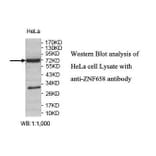 ZNF658 Antibody from Signalway Antibody (39820) - Antibodies.com
