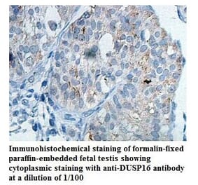 DUSP16 Antibody from Signalway Antibody (39821) - Antibodies.com