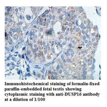 DUSP16 Antibody from Signalway Antibody (39821) - Antibodies.com