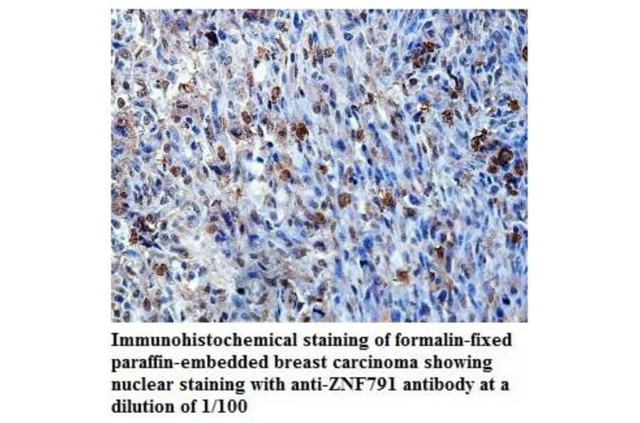 ZNF791 Antibody from Signalway Antibody (39823) - Antibodies.com