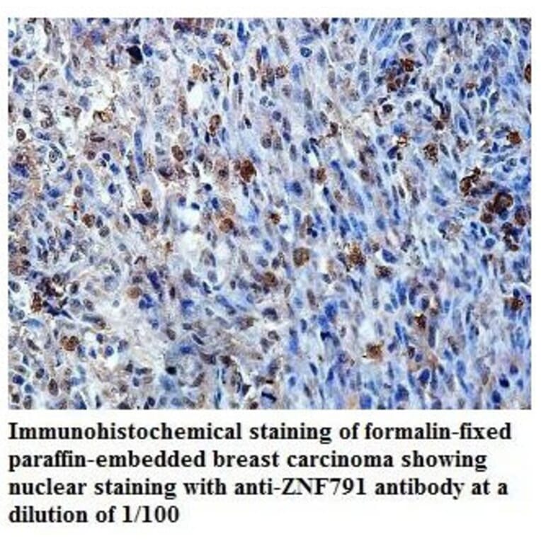 ZNF791 Antibody from Signalway Antibody (39823) - Antibodies.com