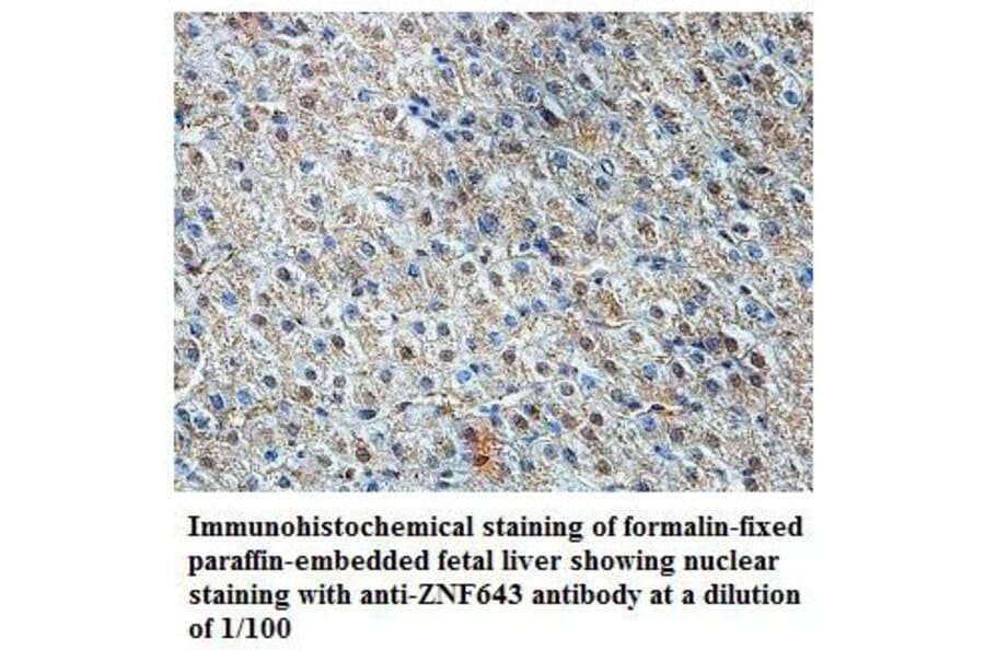 ZNF643 Antibody from Signalway Antibody (39824) - Antibodies.com