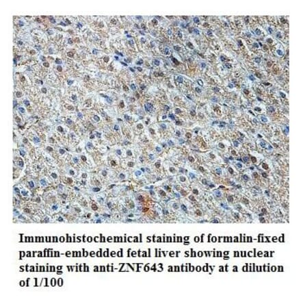 ZNF643 Antibody from Signalway Antibody (39824) - Antibodies.com