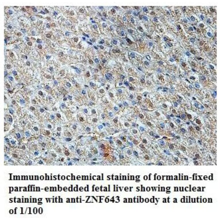 ZNF643 Antibody from Signalway Antibody (39824) - Antibodies.com
