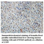 ZNF643 Antibody from Signalway Antibody (39824) - Antibodies.com