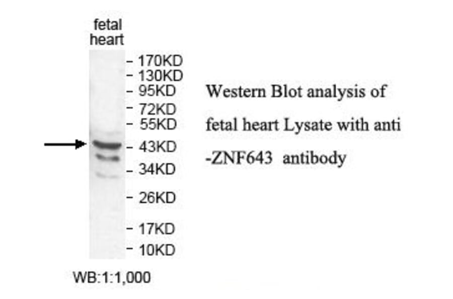 ZNF643 Antibody from Signalway Antibody (39824) - Antibodies.com