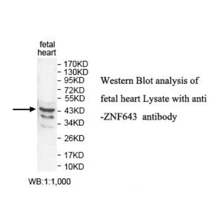 ZNF643 Antibody from Signalway Antibody (39824) - Antibodies.com