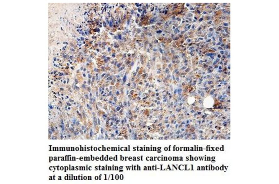 LANCL1 Antibody from Signalway Antibody (39828) - Antibodies.com