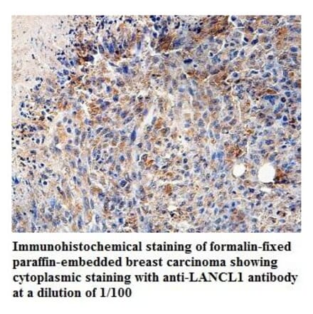 LANCL1 Antibody from Signalway Antibody (39828) - Antibodies.com