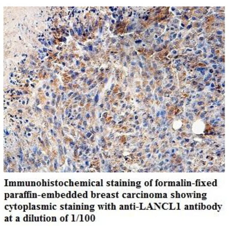 LANCL1 Antibody from Signalway Antibody (39828) - Antibodies.com