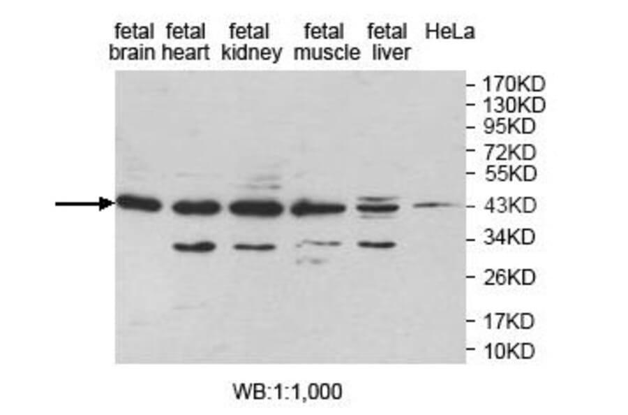 LANCL1 Antibody from Signalway Antibody (39828) - Antibodies.com