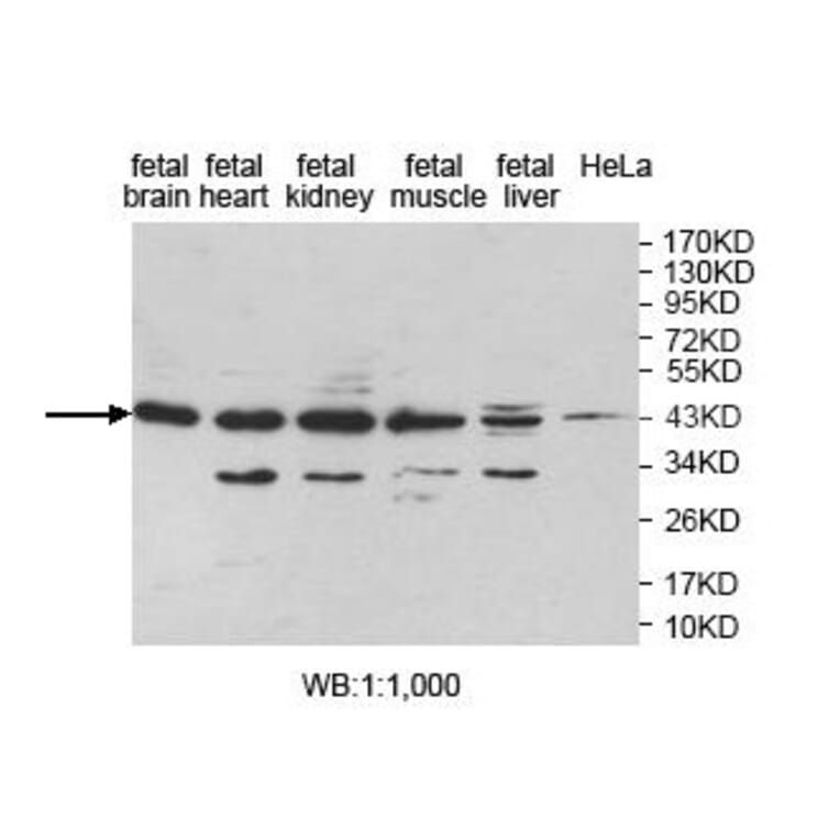 LANCL1 Antibody from Signalway Antibody (39828) - Antibodies.com