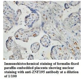 ZNF195 Antibody from Signalway Antibody (39832) - Antibodies.com