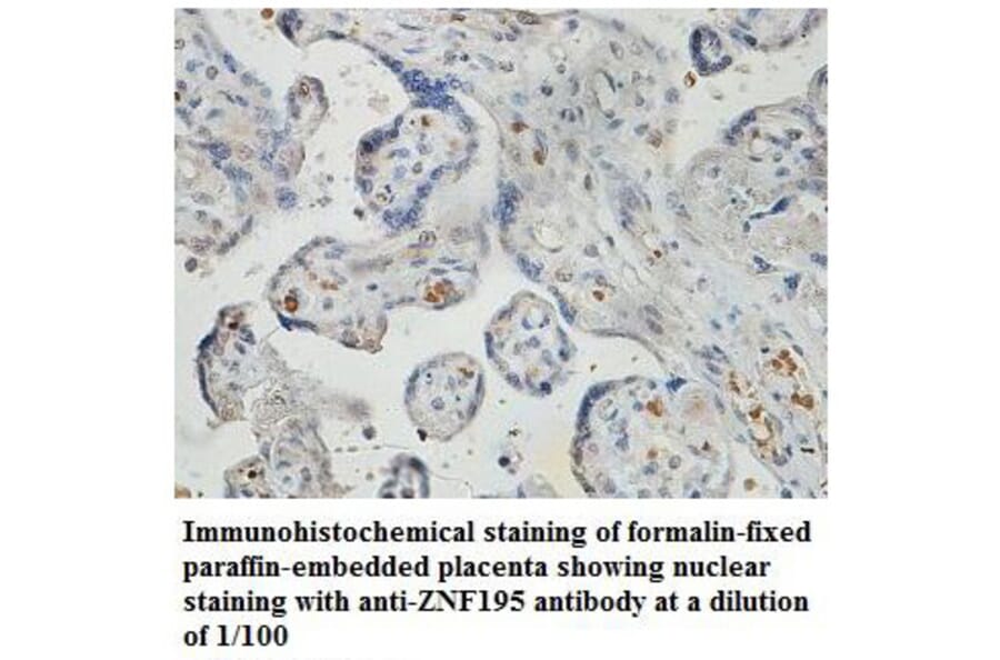 ZNF195 Antibody from Signalway Antibody (39832) - Antibodies.com