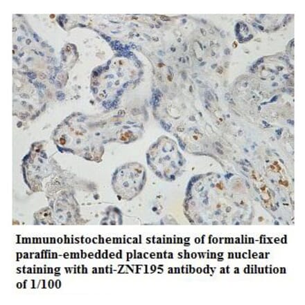 ZNF195 Antibody from Signalway Antibody (39832) - Antibodies.com