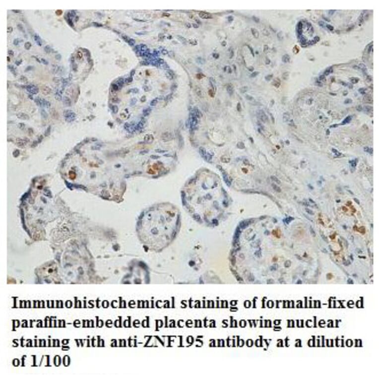 ZNF195 Antibody from Signalway Antibody (39832) - Antibodies.com