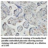 ZNF195 Antibody from Signalway Antibody (39832) - Antibodies.com