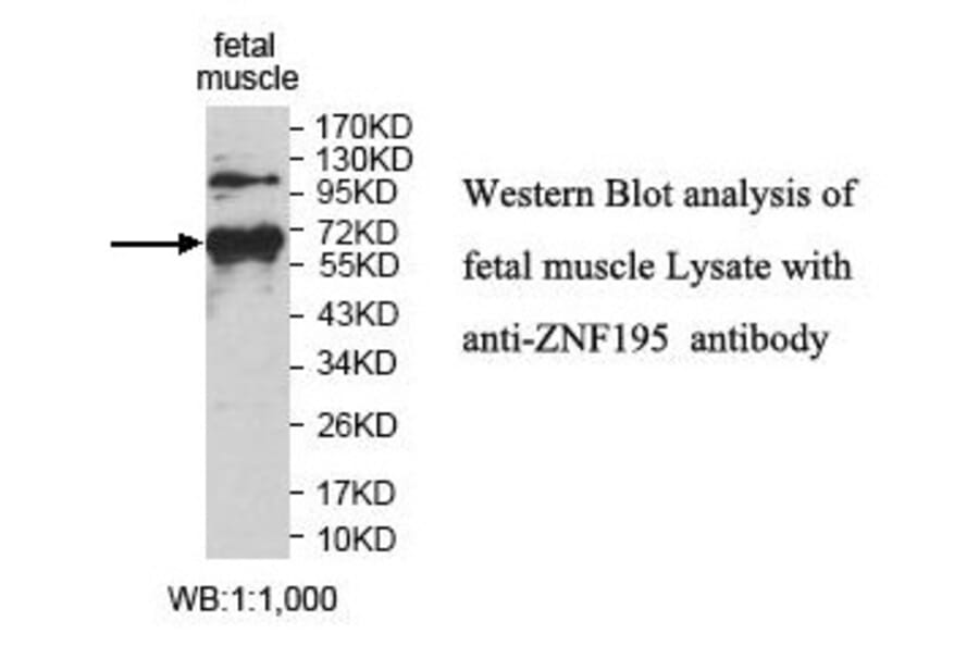 ZNF195 Antibody from Signalway Antibody (39832) - Antibodies.com