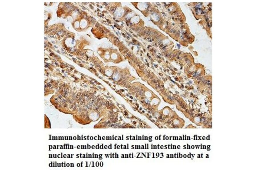 ZNF193 Antibody from Signalway Antibody (39833) - Antibodies.com