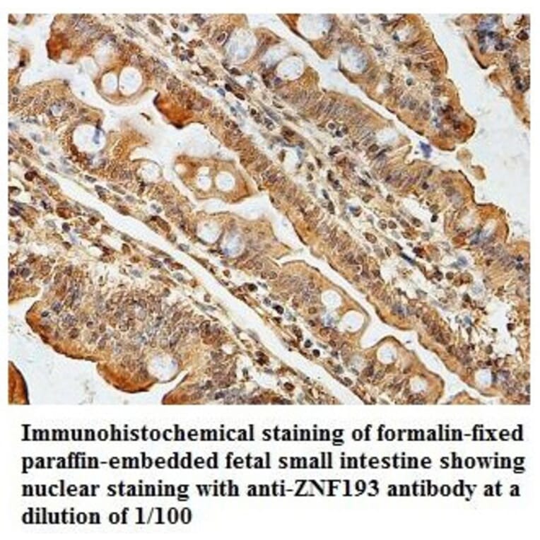 ZNF193 Antibody from Signalway Antibody (39833) - Antibodies.com