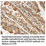 ZNF193 Antibody from Signalway Antibody (39833) - Antibodies.com