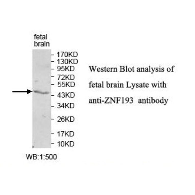 ZNF193 Antibody from Signalway Antibody (39833) - Antibodies.com
