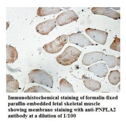 PNPLA2 Antibody from Signalway Antibody (39844) - Antibodies.com