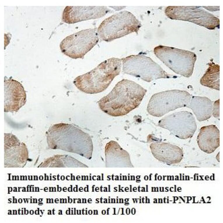 PNPLA2 Antibody from Signalway Antibody (39844) - Antibodies.com