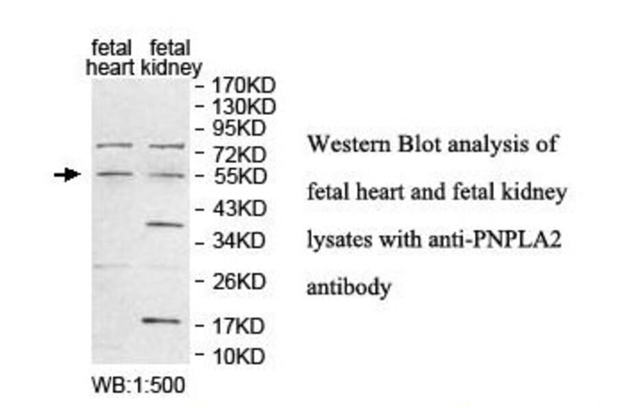 PNPLA2 Antibody from Signalway Antibody (39844) - Antibodies.com