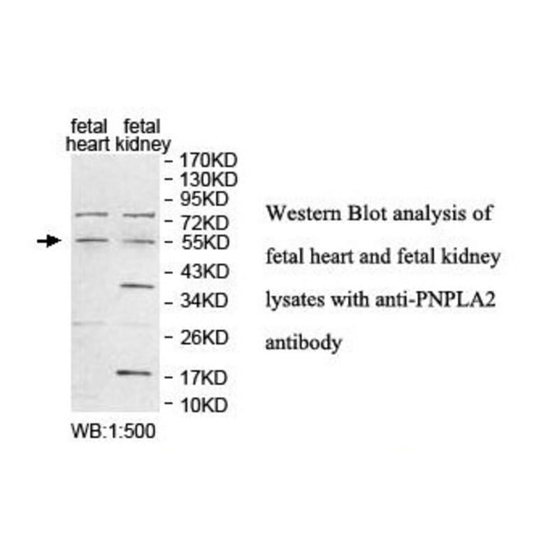 PNPLA2 Antibody from Signalway Antibody (39844) - Antibodies.com
