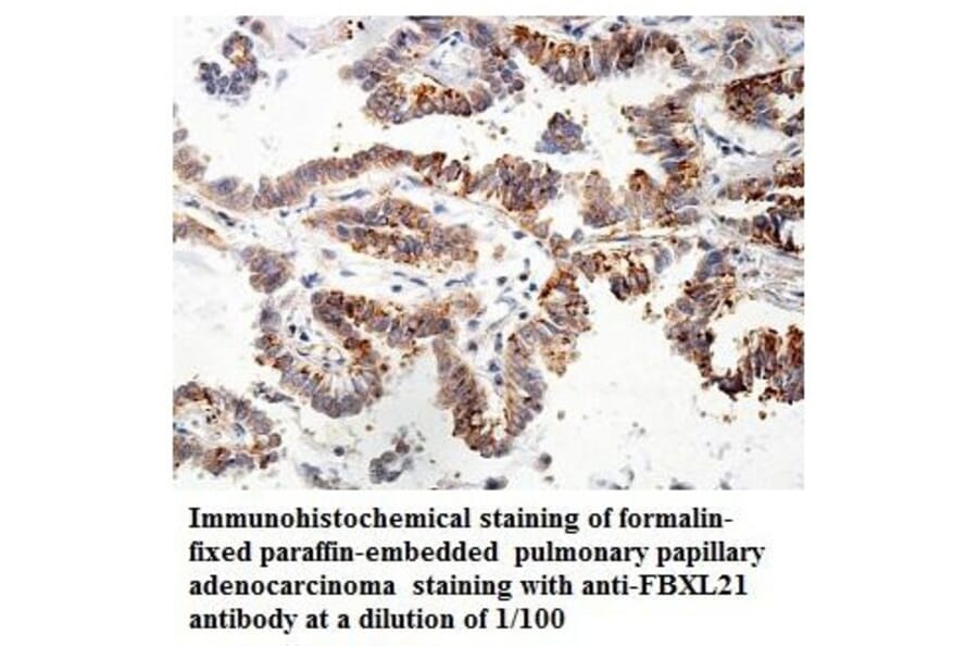 FBXL21 Antibody from Signalway Antibody (39858) - Antibodies.com