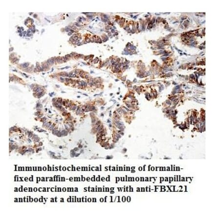 FBXL21 Antibody from Signalway Antibody (39858) - Antibodies.com