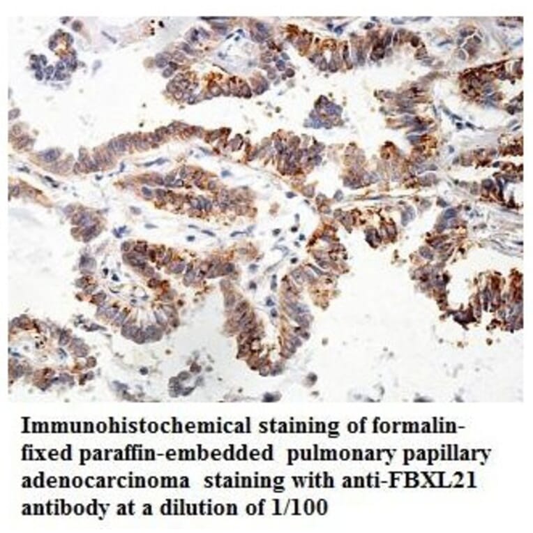 FBXL21 Antibody from Signalway Antibody (39858) - Antibodies.com