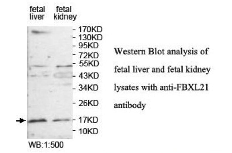 FBXL21 Antibody from Signalway Antibody (39858) - Antibodies.com