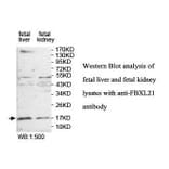 FBXL21 Antibody from Signalway Antibody (39858) - Antibodies.com