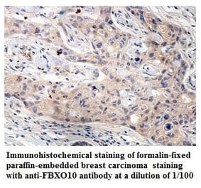 FBXO10 Antibody from Signalway Antibody (39860) - Antibodies.com