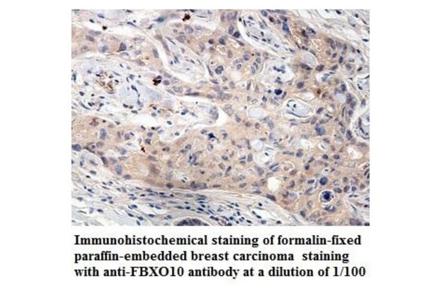 FBXO10 Antibody from Signalway Antibody (39860) - Antibodies.com