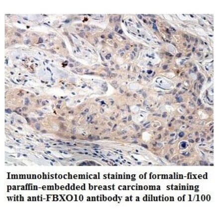 FBXO10 Antibody from Signalway Antibody (39860) - Antibodies.com