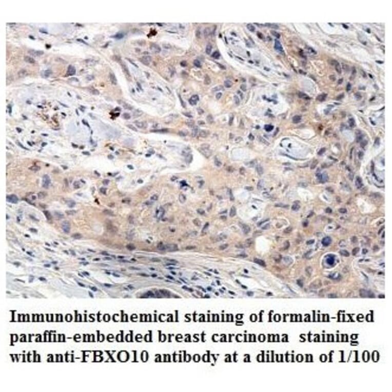 FBXO10 Antibody from Signalway Antibody (39860) - Antibodies.com